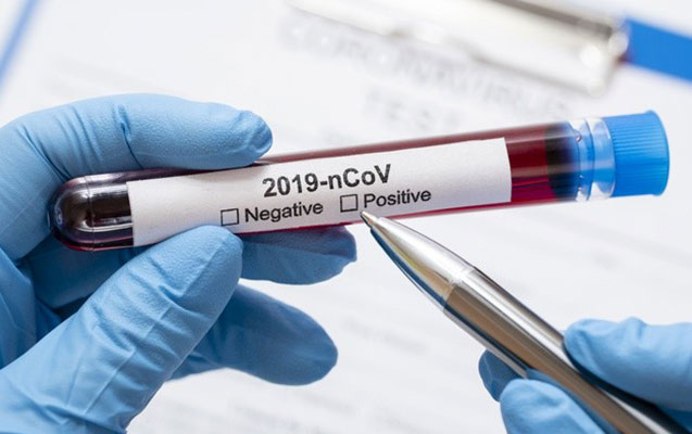isvecde-futbolculara-koronavirus-testi-mecbur-olmayacaq